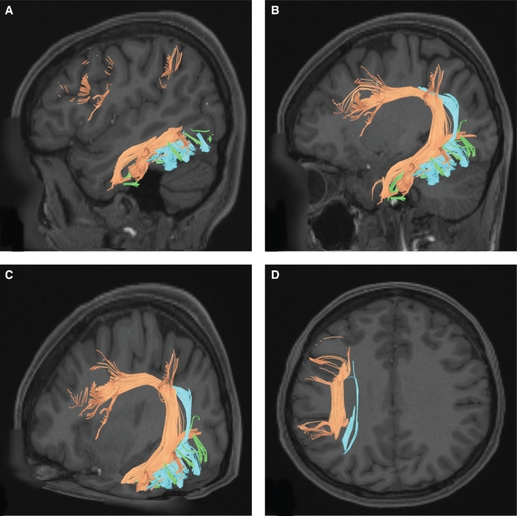 FIGURE 22.