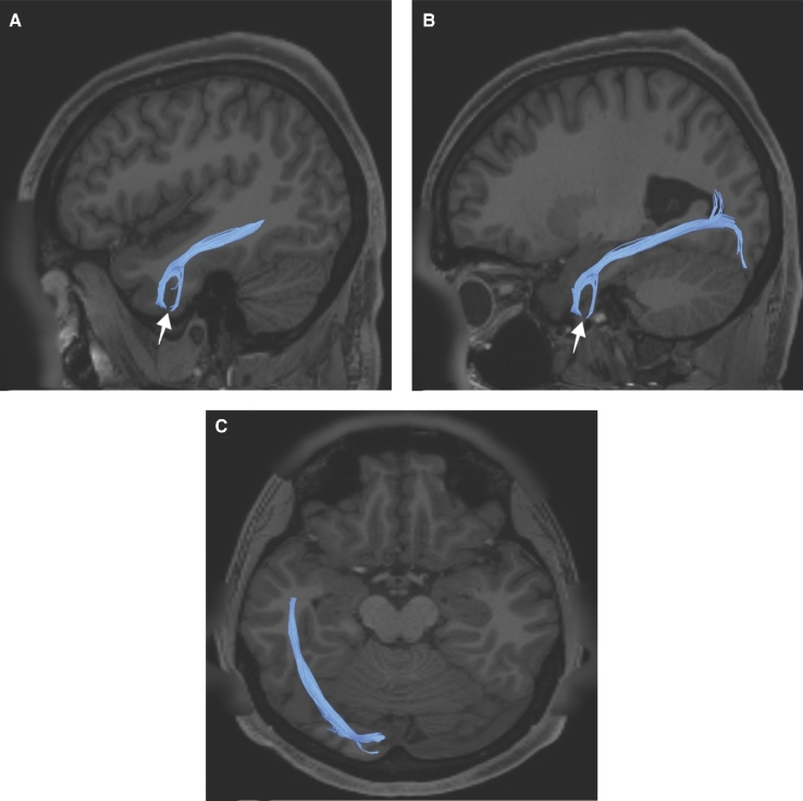 FIGURE 34.