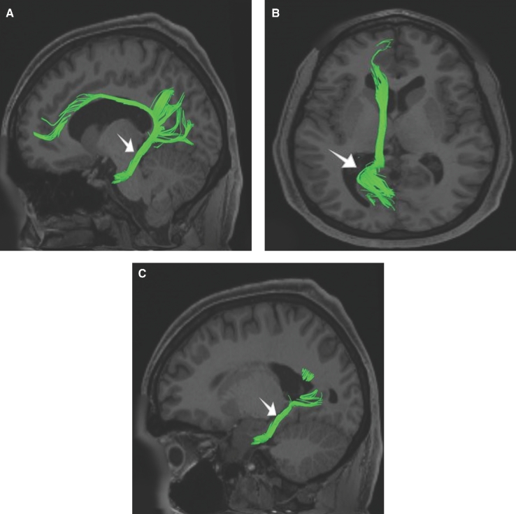 FIGURE 38.