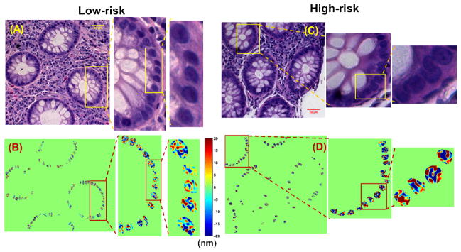 Figure 14