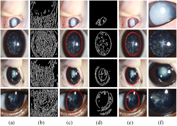 Fig 4