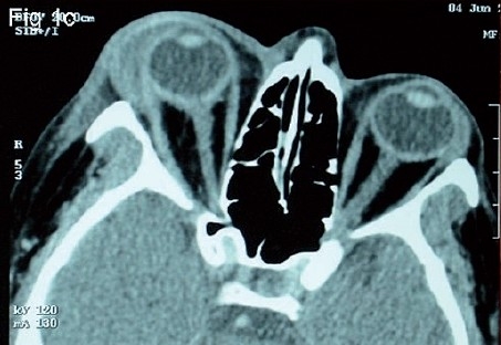 Figure 1C