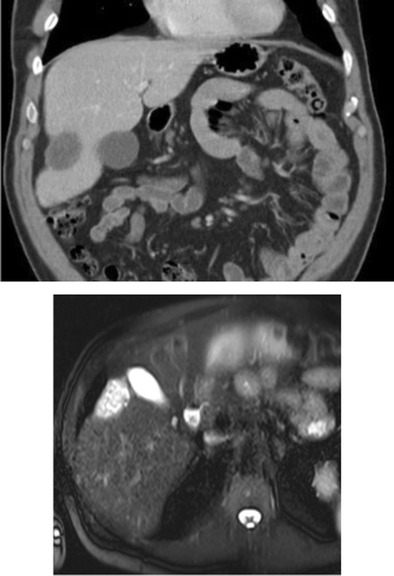 Fig. 9 & 10