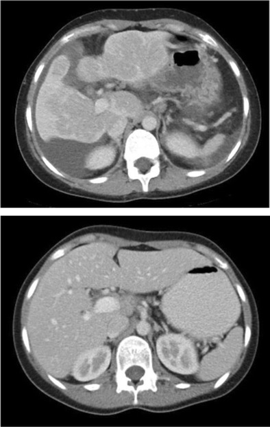 Fig. 13 & 14