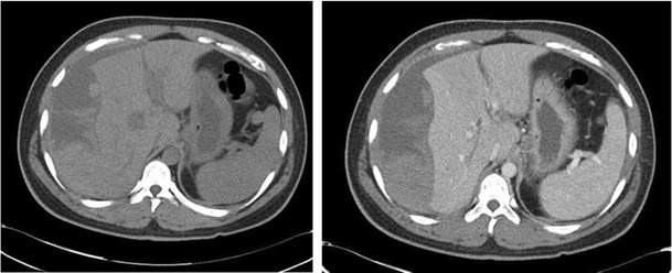 Fig. 16 & 17