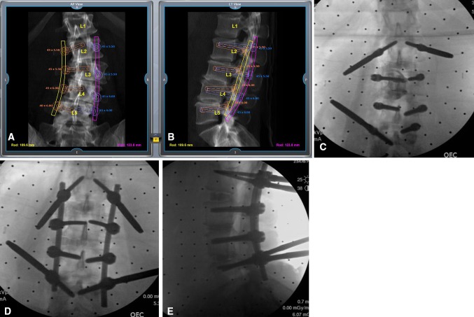 Fig. 2A–E