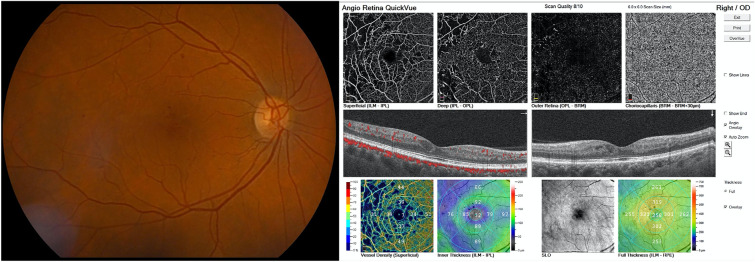 Fig. 2