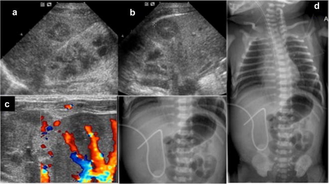 Fig. 21