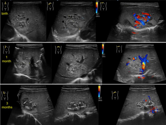 Fig. 15