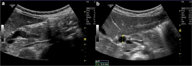 Fig. 23