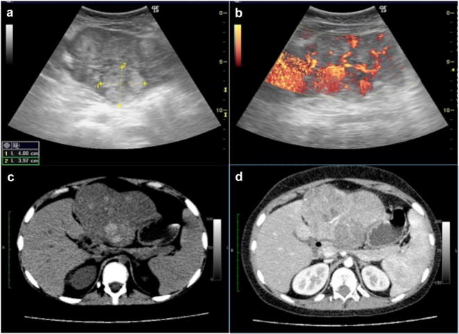 Fig. 19