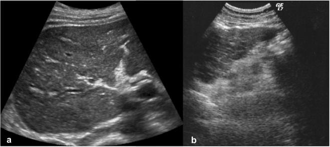 Fig. 10