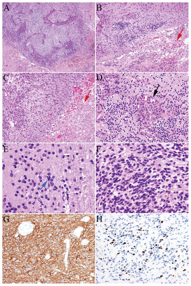 FIGURE 3