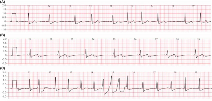 FIGURE 3