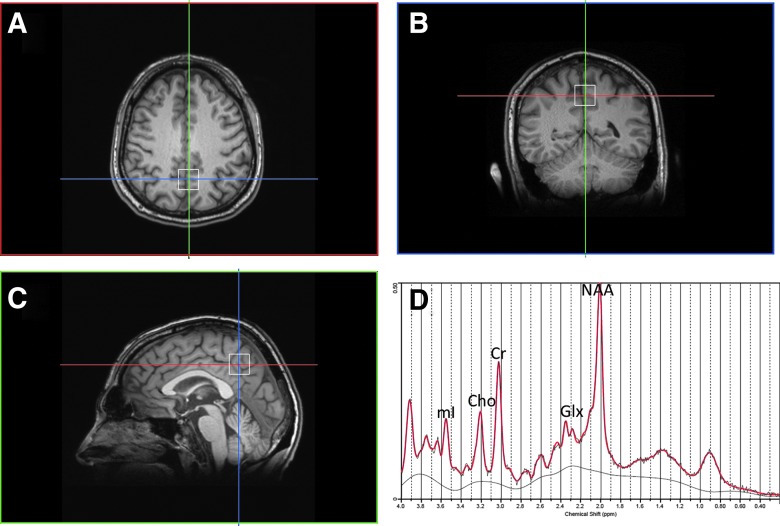 FIG. 1.