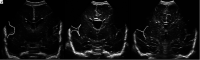 FIG 3.