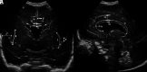 FIG 2.