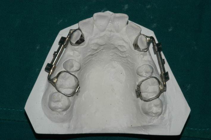 Figure 3: Construction of Distractor.