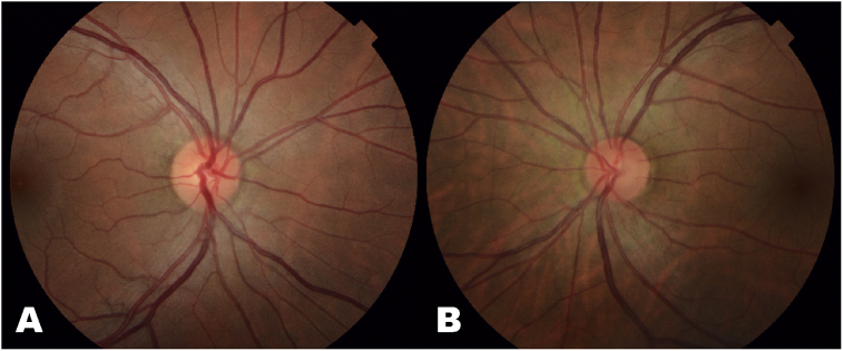 Fig. 1