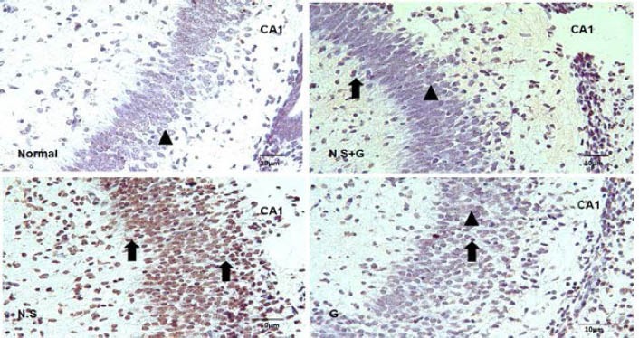 Figure 2A