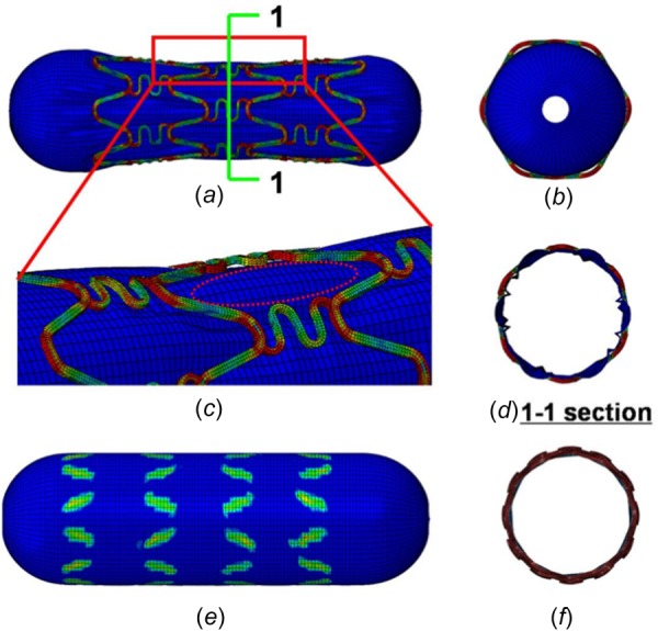 Fig. 11