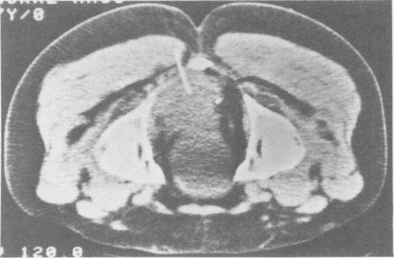 Fig. 10a.