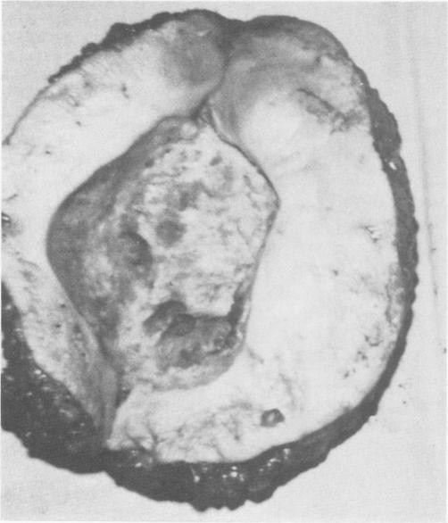 Fig. 9b.