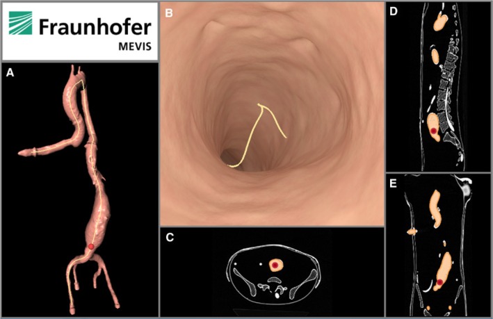 Figure 3: