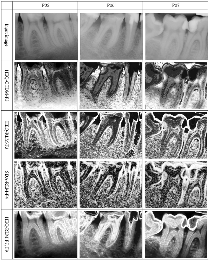 Fig. 4