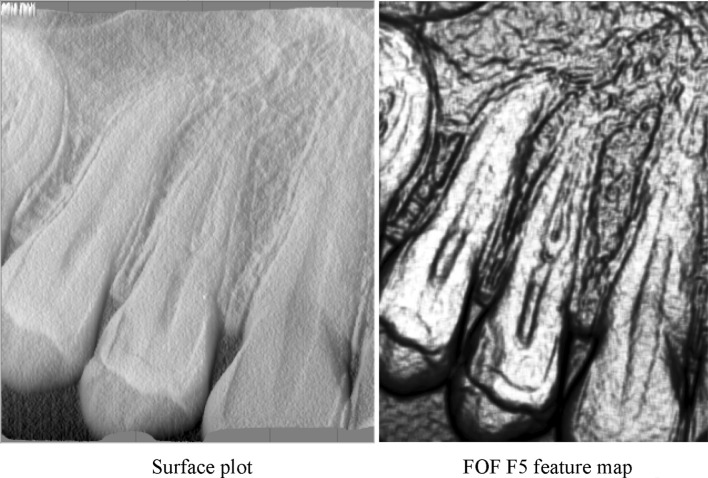 Fig. 5