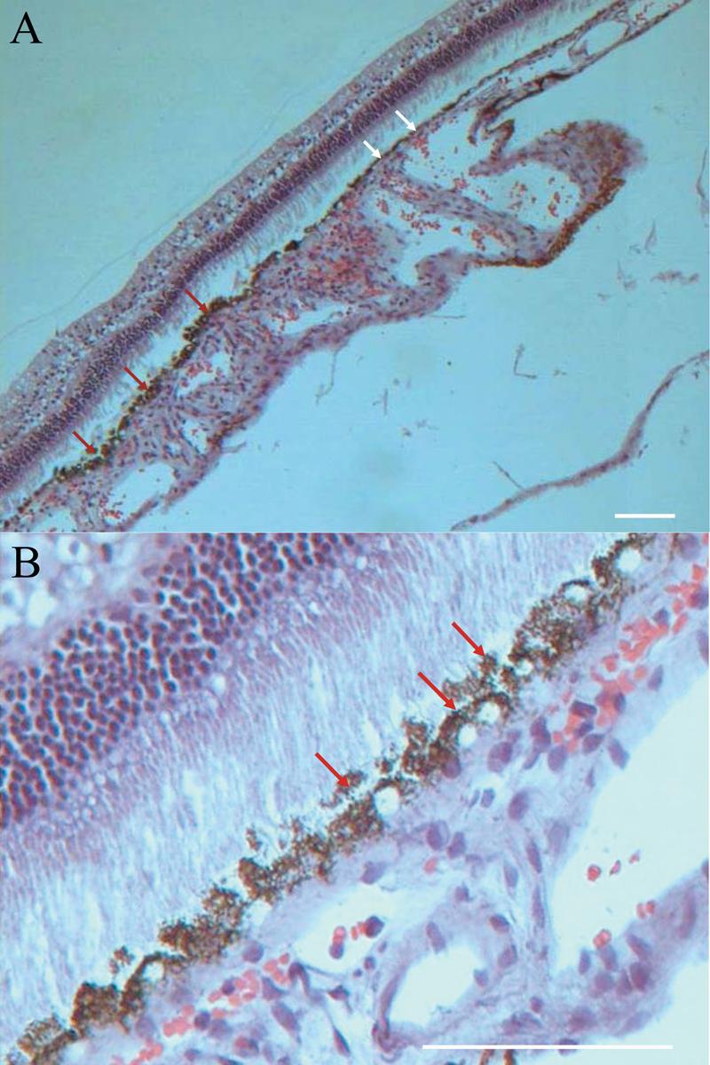 Figure 13