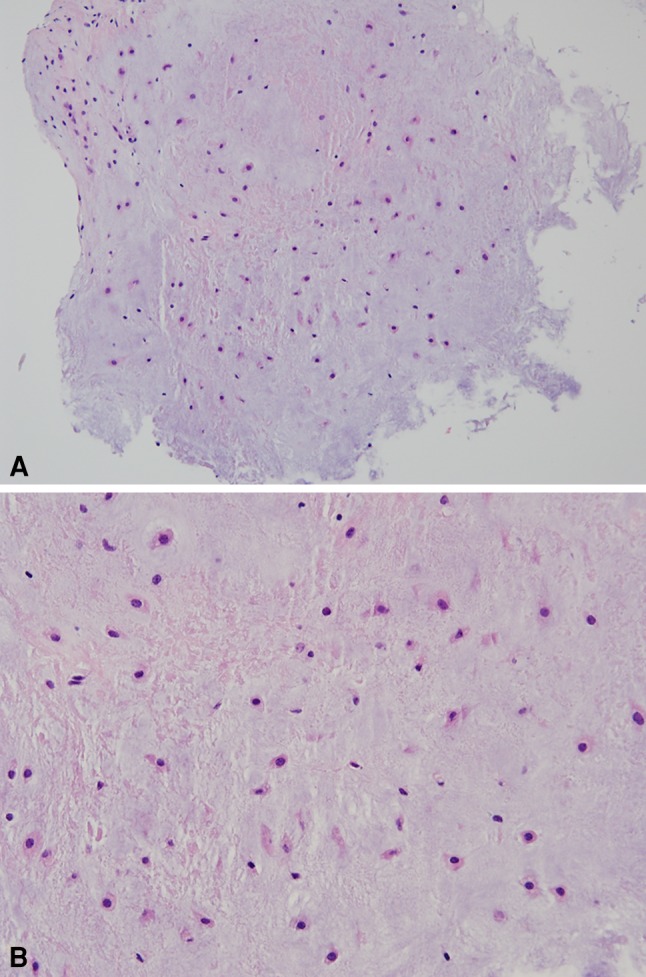 Fig. 4A–B