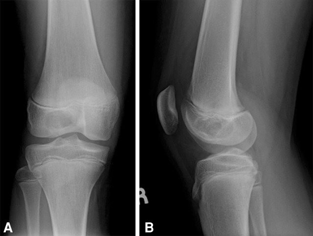 Fig. 6A–B
