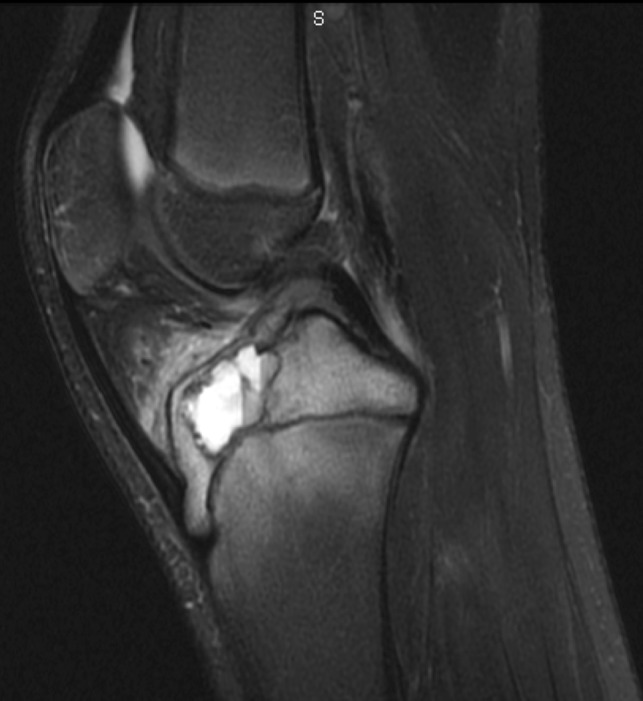 Fig. 5