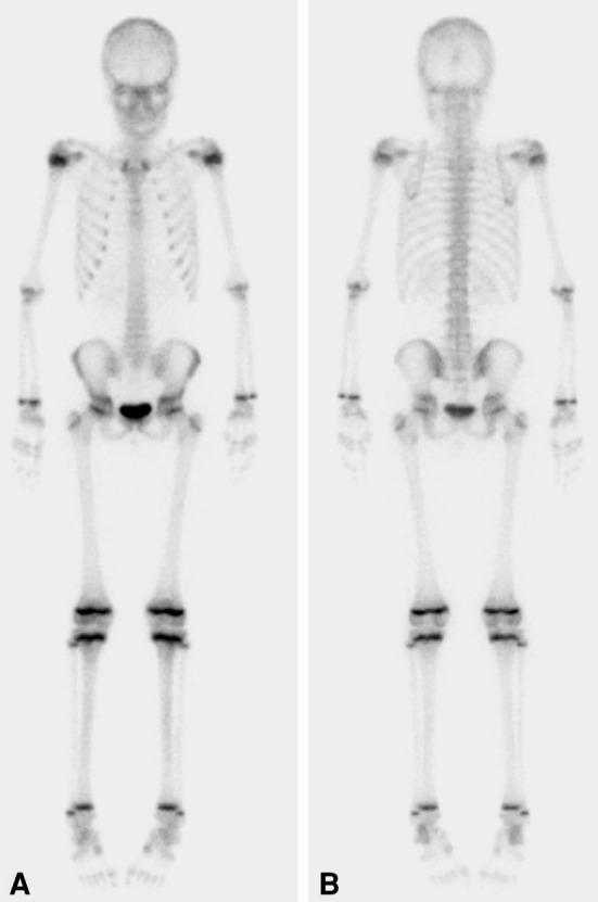 Fig. 3A–B
