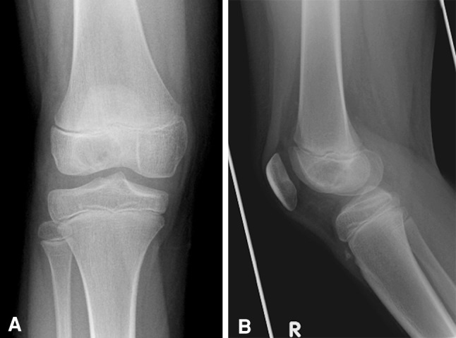 Fig. 1A–B