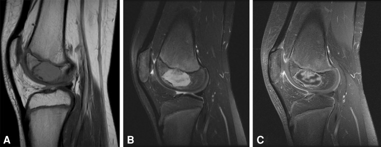 Fig. 2A–C