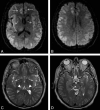 Fig 3.