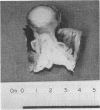 90