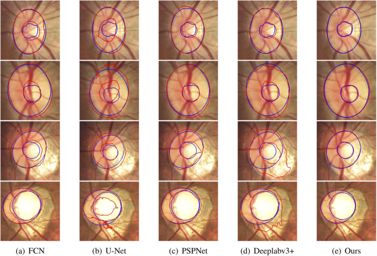 Fig. 12.