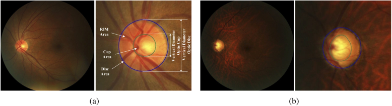 Fig. 1.