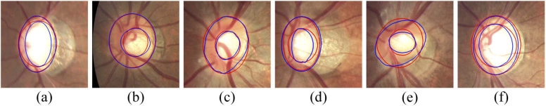 Fig. 14.