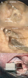 Figure 1: