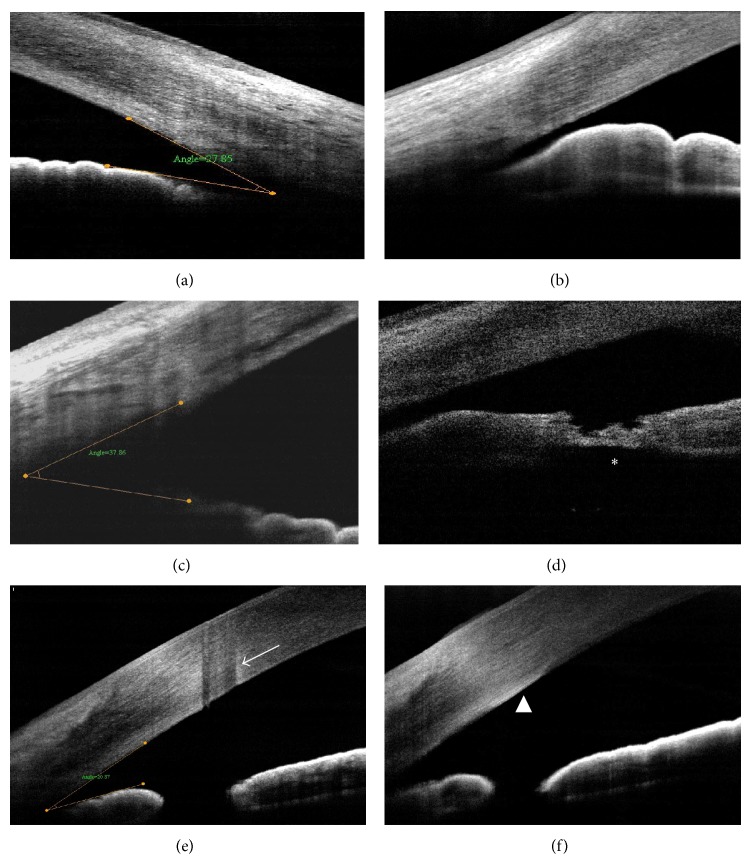 Figure 11