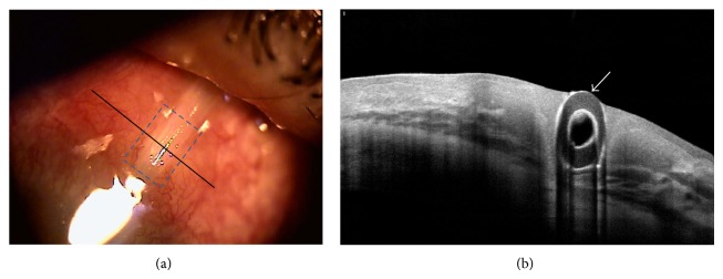 Figure 13