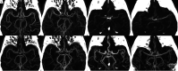FIG 2.
