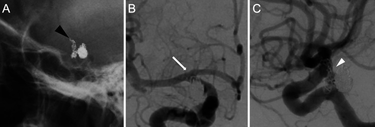 FIG. 2.