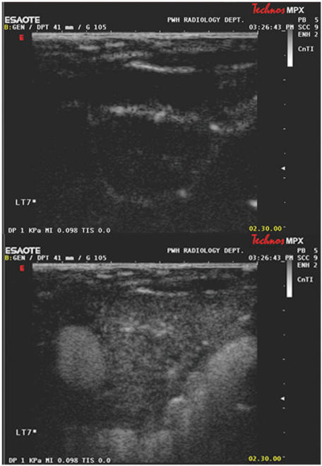 Figure 10