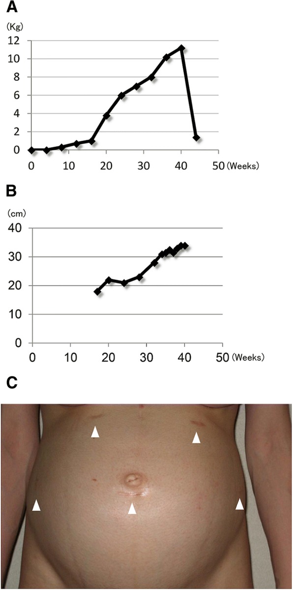 Fig. 2