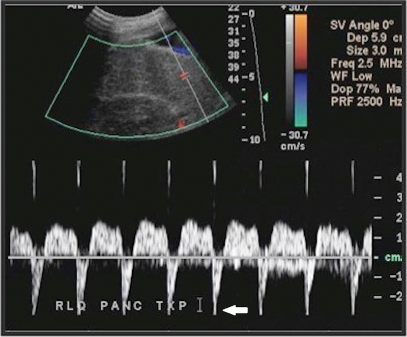 Fig. 17